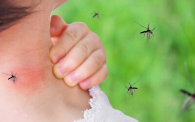 Zanzare, perché alcune persone vengono punte di più?